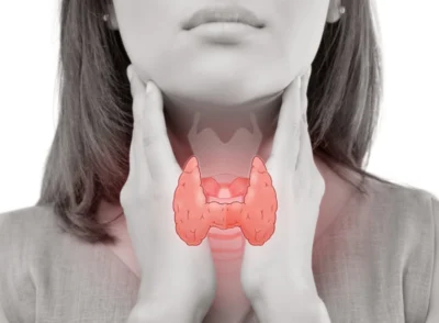 Diet plan for Thyroid